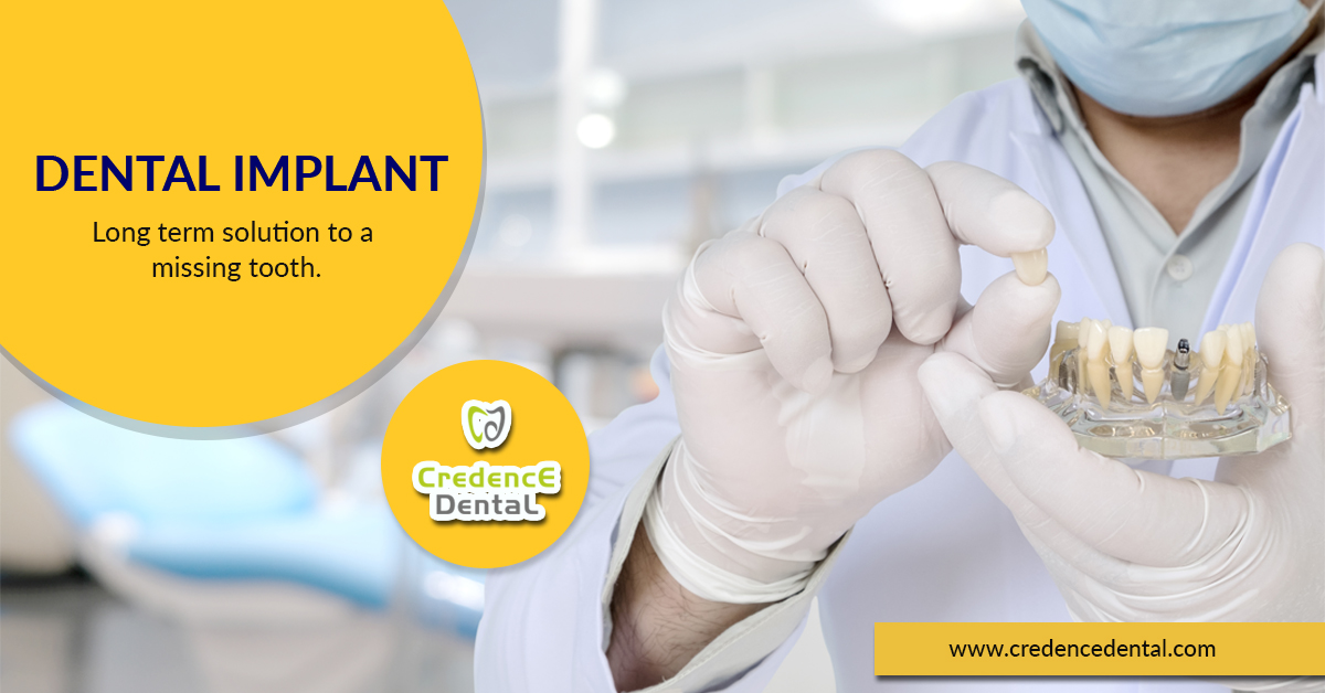 The Best Dental Clinic in Bangalore – Credence Dental