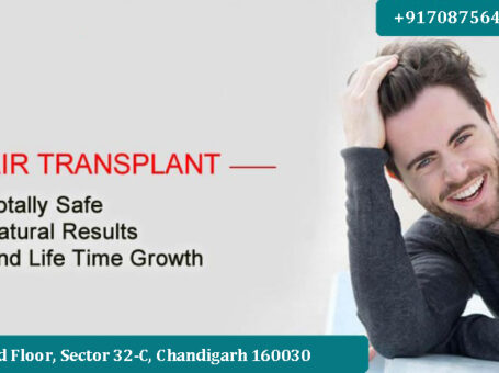 Best Bio FUE hair Transplants in Chandigarh