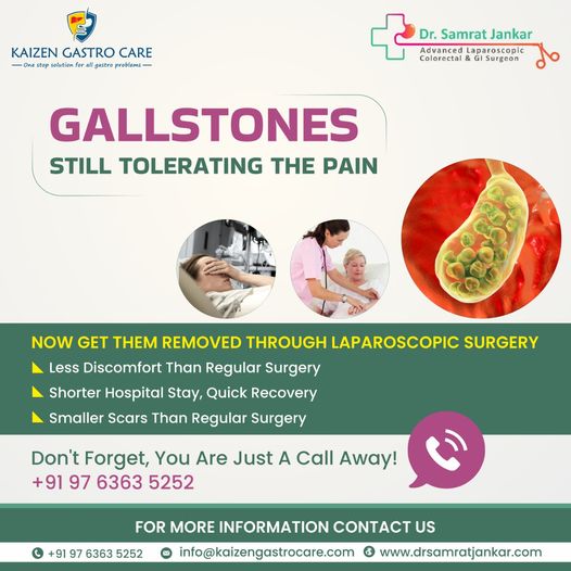 Gallstone tollerating the pain- Dr. Samrat Jankar