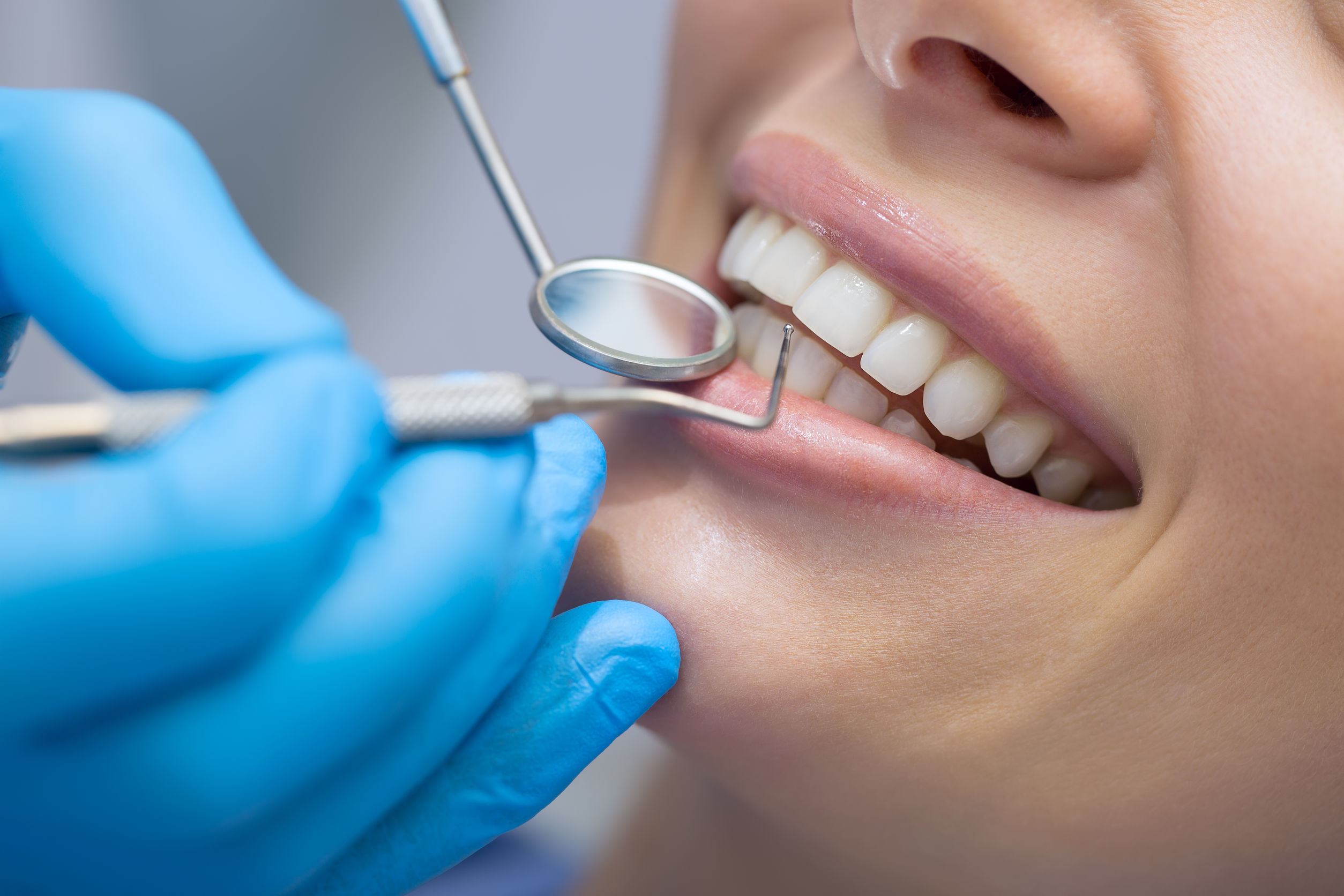 Best Dentist Hospital in Hyderabad | Capture Life Dental Care