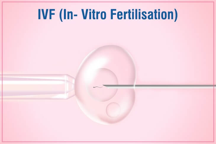 IVF Image Website
