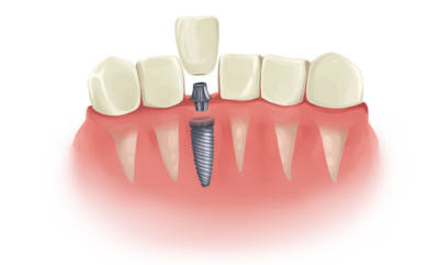 McClane Dentistry Best Stuart Dentist