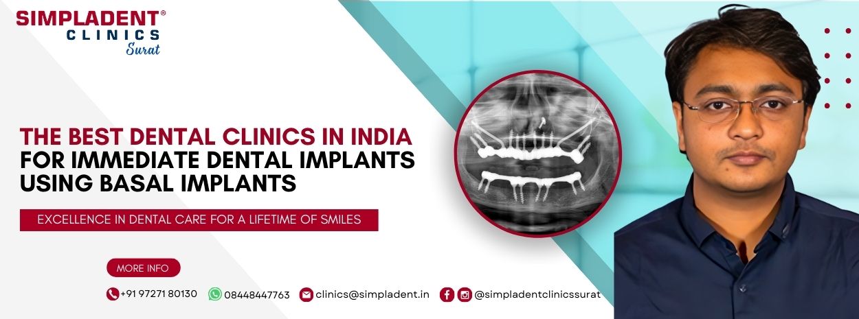 Dr. Aroon K. Bengani Implantologist In Surat