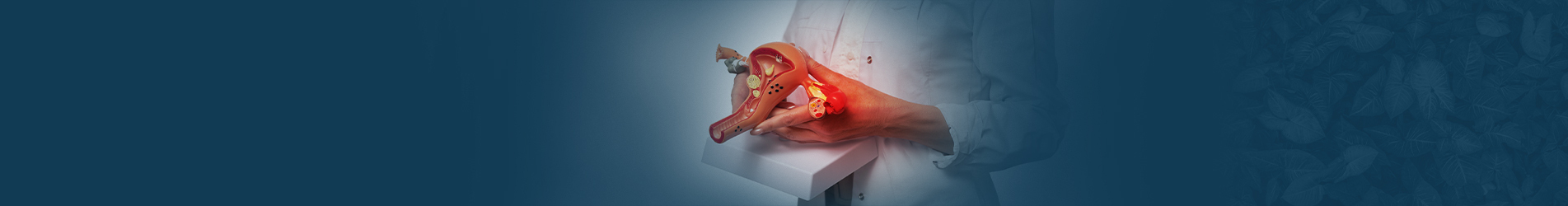 Best Ovarian Cancer Treatment Hospitals in Hyderabad