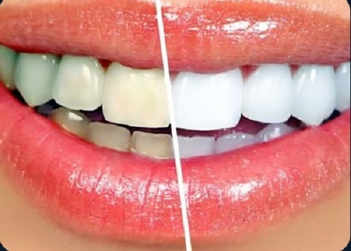 Tattva Dental Care – Best Dental Clinic in Padmanabhanagar,Banashankari