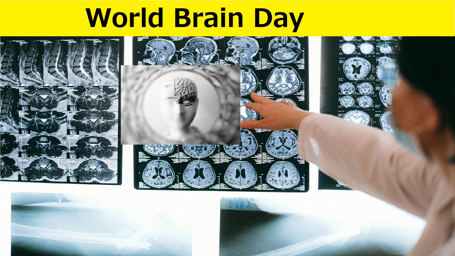 World Brain Day 2025
