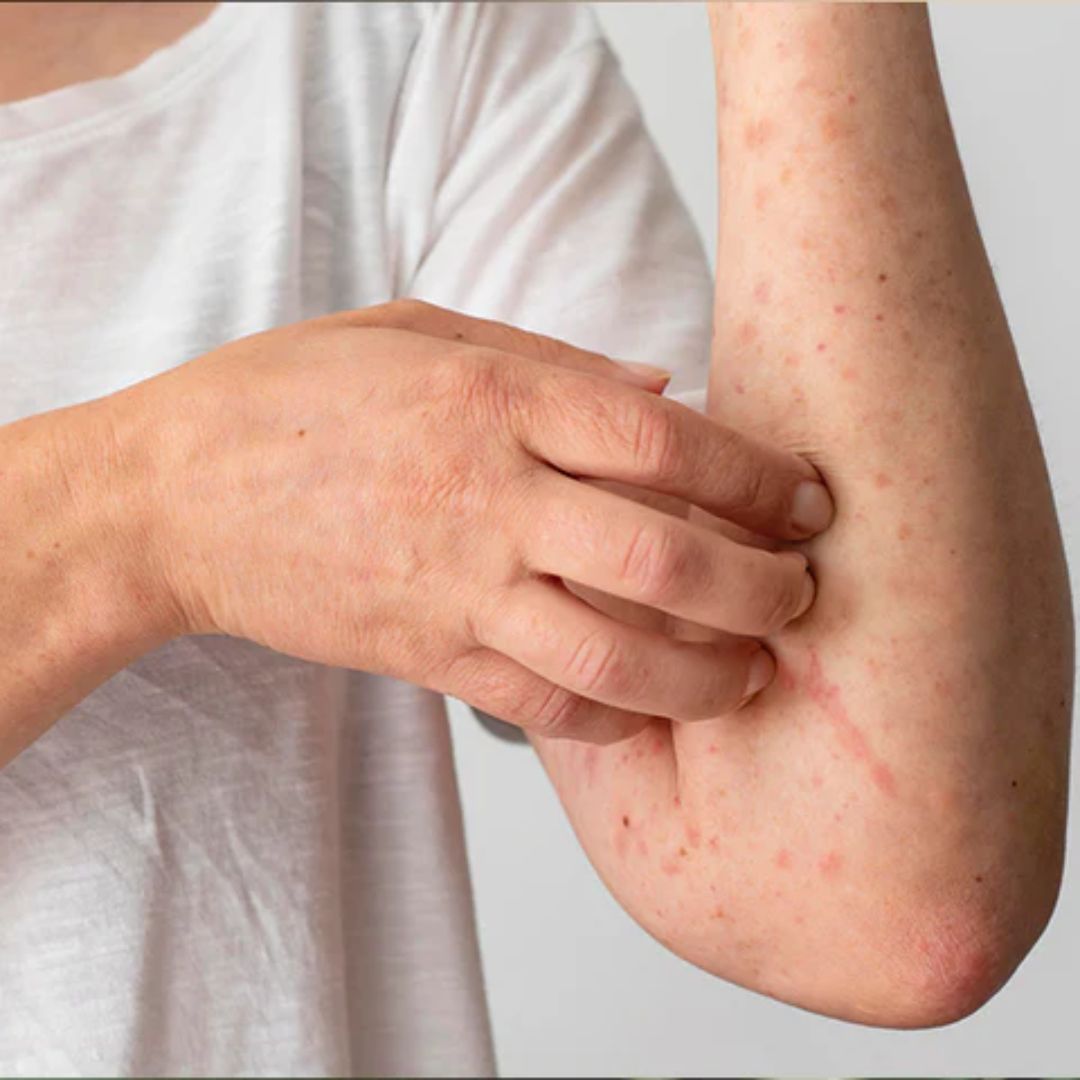 Top Skin Cancer Hospitals in India