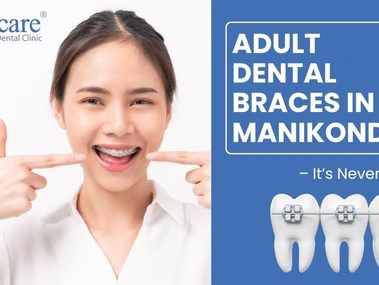 Bracecare Dental – Best Dental Clinic in Manikonda | Invisalign & Braces Hyderabad