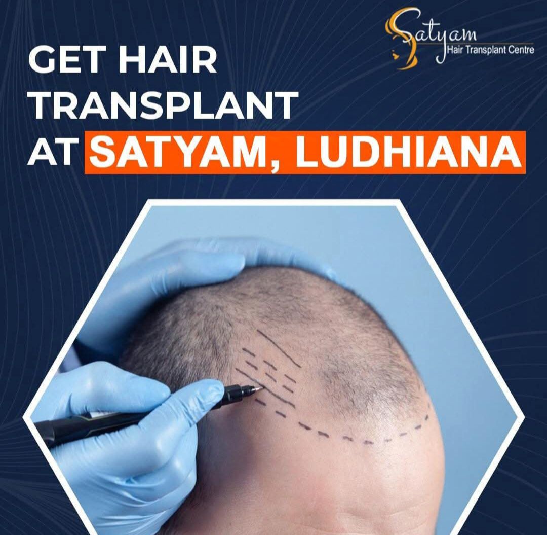 Hair Transplant Surgeon in Ludhiana | Satyam Hair Transplant