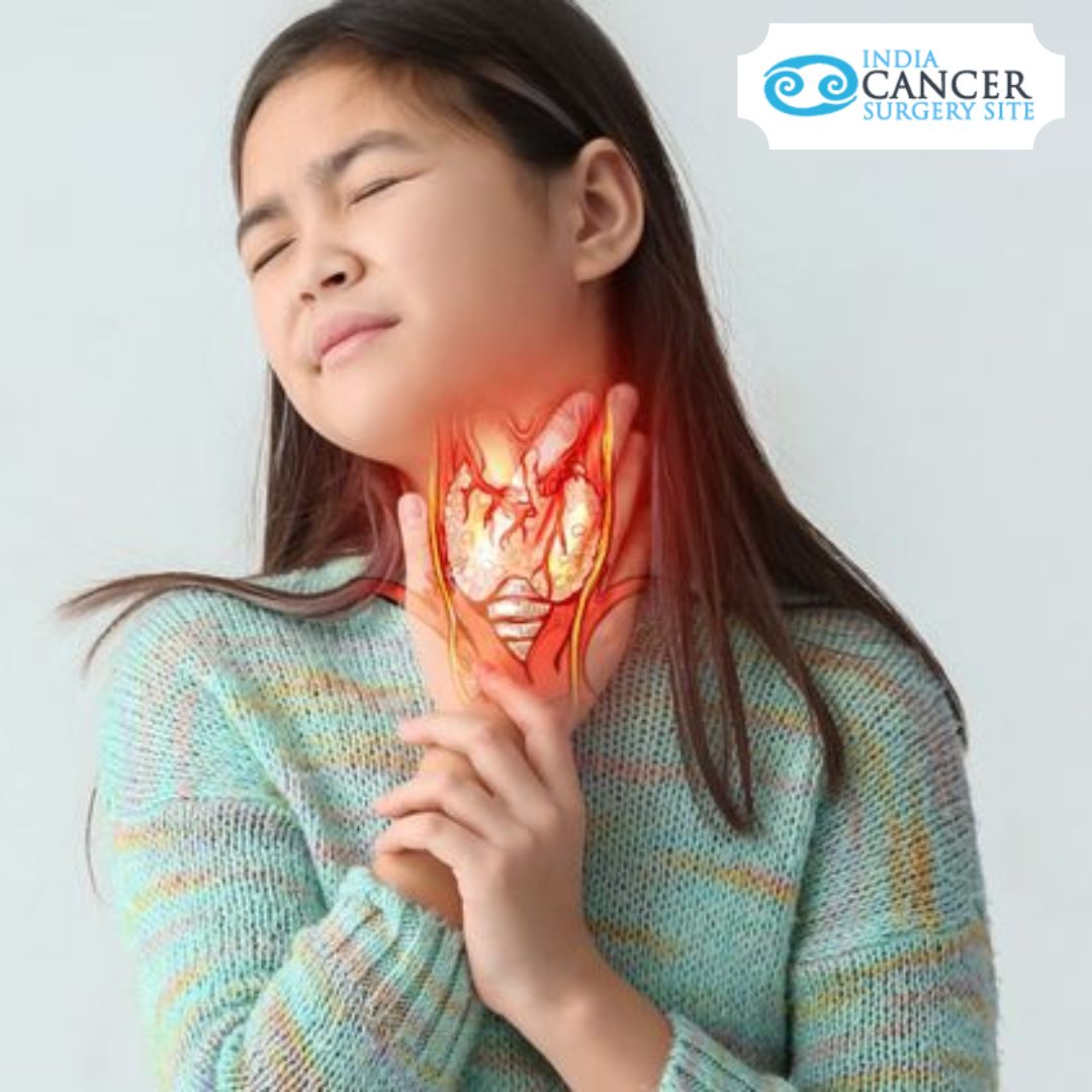 Low Cost Throat Cancer Treatment in India