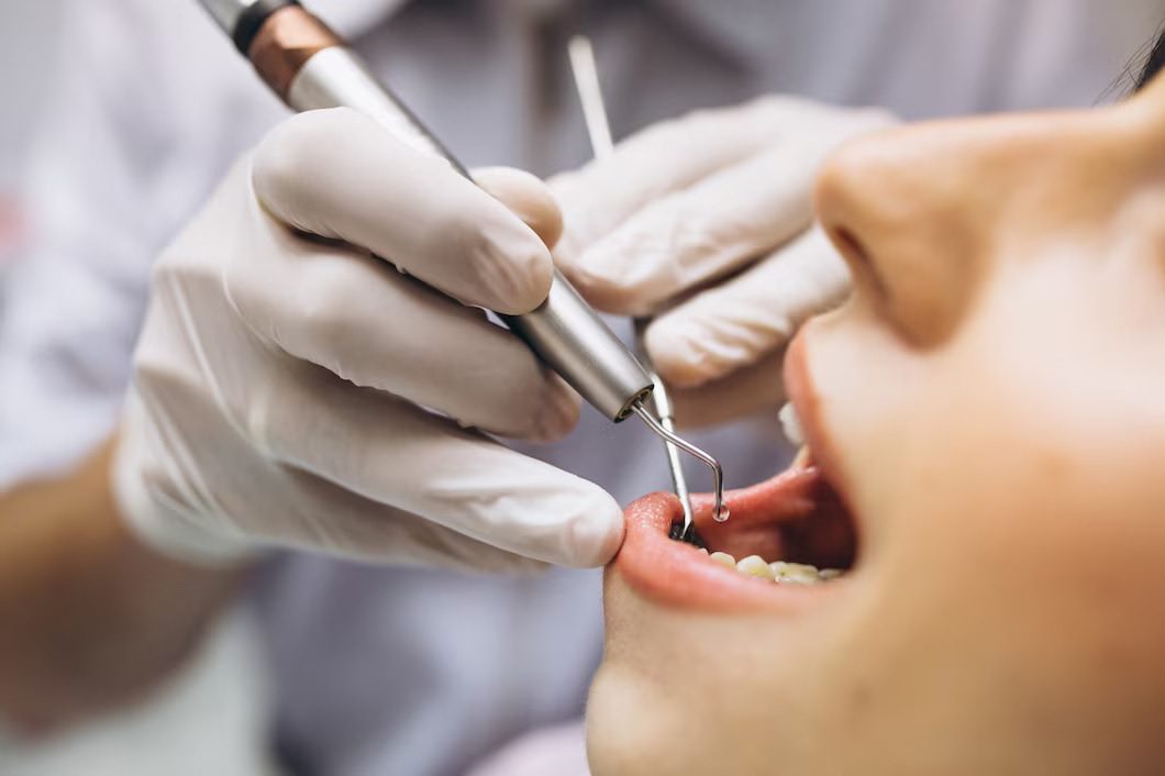 Best Smiles Dental Clinic – Manikonda, Hyderabad