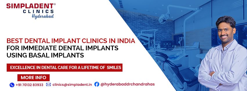 Dental Implant Clinic Near Me