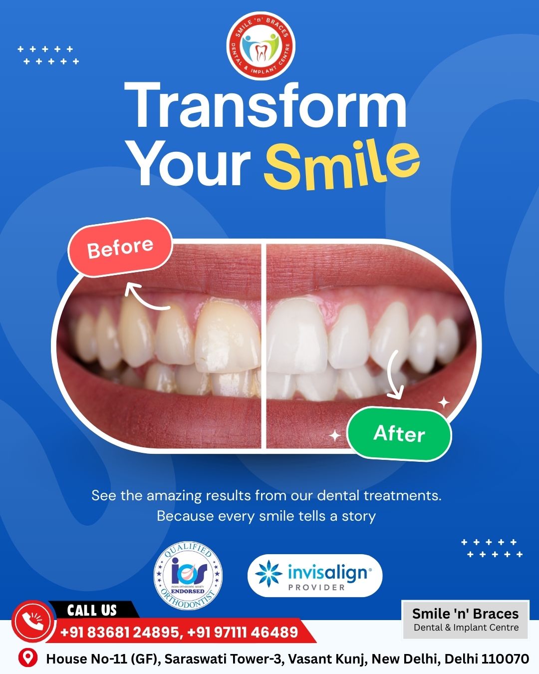 Smile n Braces Dental Clinic - Invisalign, Implants, Veneers