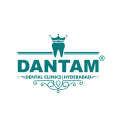 Dantam Dental Clinic Kondapur | Best Dentist & Family Dental Care