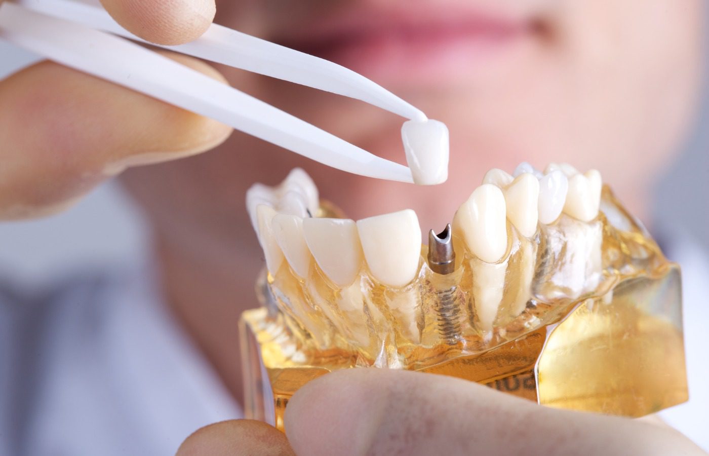 Trusted Dental Clinic in Pune for Advanced Cosmetic Dental Care